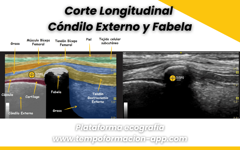 3. Ecografia tempo formacion rodilla.png